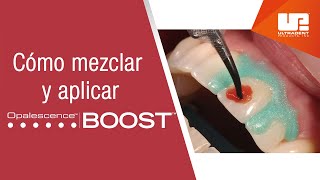 Cómo mezclar y aplicar el blanqueamiento dental médico Opalescence™ Boost™ [upl. by Allebasi]