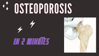 Osteoporosis in 2 mins [upl. by Crysta]