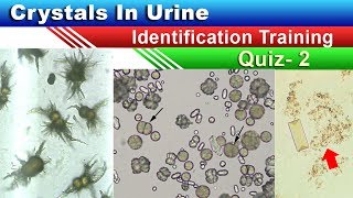 Crystals In Urine Identification Training Quiz  Part 25 [upl. by Eekorehc]