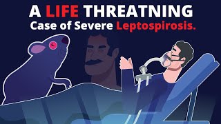 What is Leptospirosis How does it cause Organ Failure amp How to treat [upl. by Dorcea146]