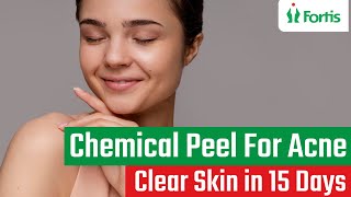 Part 2Chemical Peel  Skin Peeling TreatmentChemical Peel For AcneChemical Peel For Acne ScarMUL [upl. by Airb]