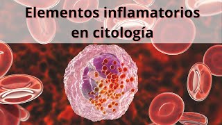 Elementos inflamatorios en citología Glóbulos blancos Leucocitos [upl. by Eserehs967]