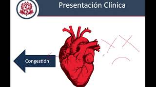 Insuficiencia Cardiaca  Fisiopatología Clínica y Diagnostico [upl. by Aenil]