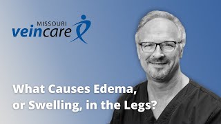 What Causes Edema in My Legs [upl. by Jerrilee]