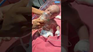 Nebuliser newbornbaby medical viralshort [upl. by Vanthe]