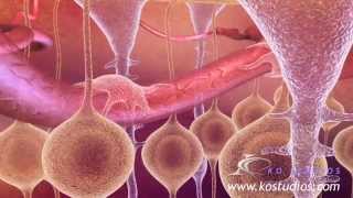 Diabetic Retinopathy [upl. by Antrim]