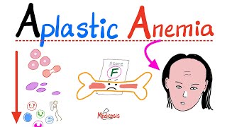 Aplastic Anemia  All you need to know  Definition Causes Symptoms Diagnosis amp Treatment [upl. by Atinaw]