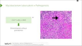 Mycobacteria MTB lecture Microbiology Medicos Study Corner [upl. by Yrakaz281]