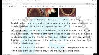 Treatment of Class II division 1 malocclusion المرحلة الخامسة [upl. by Laehplar738]