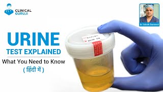 Urine Test Explained What You Need to Know [upl. by Laflam]