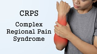 Complex Regional Pain Syndrome CRPS [upl. by Hayifas]