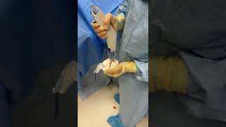 Orthopedic surgery operationtheatre operationtheatretechnician orthopedics shorts [upl. by Yentrac850]