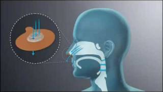 Provent Therapy Mechanism of Action How EPAP Works [upl. by Tigdirb]