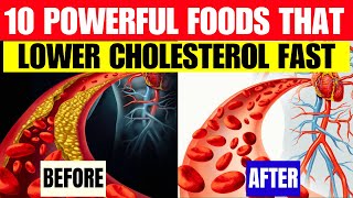 Top 10 Powerful Foods That Lower Cholesterol Fast [upl. by Anirav]