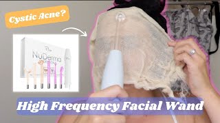 Testing out a HighFrequency Facial Wand for acne NuDerma Professional Skin Therapy Wand [upl. by Accebber223]