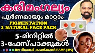 Natural remedy for pigmentation  കരിമംഗല്യം മാറാൻ 3 നാച്ചുറൽ ഫേസ് പാക്ക്Karimangalyam home remedy [upl. by Anidan]