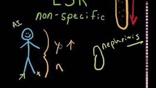 ESR Blood Test Erythrocyte Sedimentation Rate [upl. by Holms]