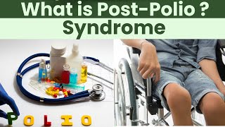 Post Polio Syndrome  Causes Symptoms and Treatment [upl. by Margarette]