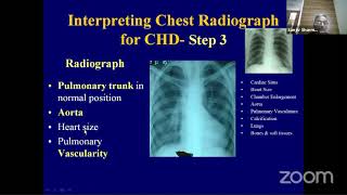 Chest X Rays in Congenital Heart Disease [upl. by Aserehc]