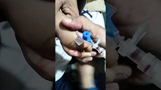 Easy pass I v cannula procedure youtubeyoutuberhospitalyoutubeshortscutebabyyoutubeshorts [upl. by Lotz304]