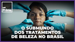 Do botox ao PMMA Brasil é paraíso de intervenções que são caso de polícia [upl. by Alton]