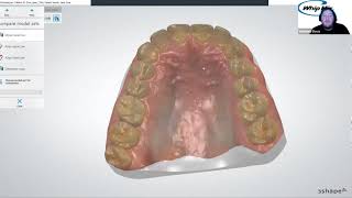 Webinar 3Shape Aligner Studio with Ortho Analyzer with Matthew Davis [upl. by Fira162]