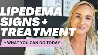 Lipedema symptoms  treatment including liposuction [upl. by Nyssa790]