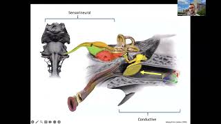 Blum Center Program Hearing Loss Hearing Aids and Tinnitus [upl. by Nae]