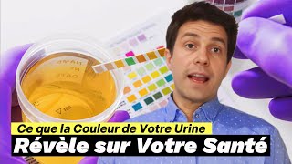 Ce que la Couleur de Votre Urine Révèle sur Votre Santé [upl. by Trebeh656]