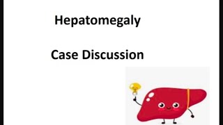 Case Presentation Veno occulsive disease Differential Diagnosis of Hepatomegay [upl. by Trebmal]