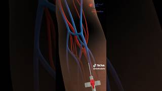 How This Cannula Procedure Transformed My Body 3D Animation shorts 3danimation cannula anatomy [upl. by Ahsillek]