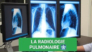 RADIOLOGIE☢️ EXPLORATION RADIOLOGIQUE PULMONAIRE🫁3ÈME MÉDECINE ✅UNITÉ1🫀🫁 [upl. by Haliek519]