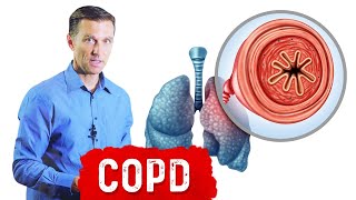 Chronic Obstructive Pulmonary Disease COPD [upl. by Lachance]