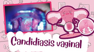 Candidiasis vaginal  Vaginal yeast infection [upl. by Arber]