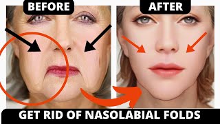 🛑 HOW TO GET RID OF NASOLABIAL FOLDS WITH FACE YOGA  LIFT JOWLS amp SAGGY SKIN  FROWN LINES [upl. by Hanikahs340]