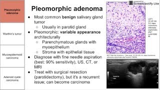 Salivary Gland Neoplasms [upl. by Rodrigo205]