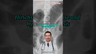 7 Surprising Causes of Megacolon You Need to Know [upl. by Trebeh]