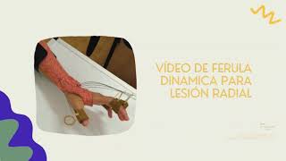 Férulas dinámicas para lesión radial Terapia de miembro superior y mano en Terapia Ocupacional [upl. by Kepner]