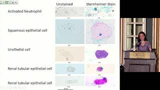 5 Current Approaches to Urine Sediment Analysis [upl. by Bor50]