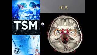 INTERNAL CAROTID ARTERY LECTURE [upl. by Asssilem678]