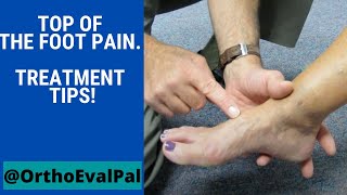 Top of the foot pain Treatment tips [upl. by Nilde524]