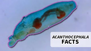 Acanthocephala Facts the Thorny Headed Worm  Animal Fact Files [upl. by Ping85]