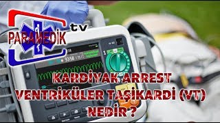 EKG  ÖLÜMCÜL RİTİMLER  NABIZSIZ VENTRİKÜLER TAŞİKARDİ ye yaklaşım [upl. by Nagem]