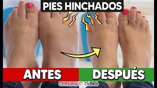 🦶🏻🔥 4 FORMAS de disminuir los PIES HINCHADOS durante el embarazo [upl. by Gram]