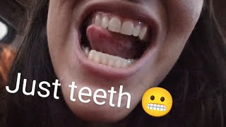 💋 Showing my teeth Subscriber request 😬 Comment for more teeth [upl. by Tengdin]