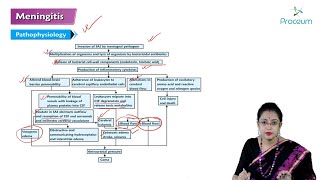 Meningitis Hindi  Internal Medicine [upl. by Brent]