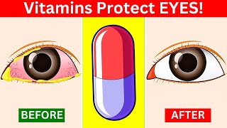 6 Vitamins That Protect Eyes and Repair Vision [upl. by Alehc]