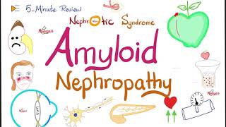 Amyloid Nephropathy  Kidney Pathology Lectures [upl. by Akimak69]