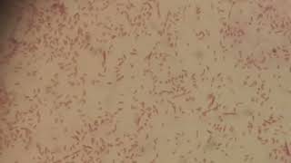 Gram Negative Bacteria Aeromonas hydrophila in Gram Staining [upl. by Federico]