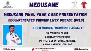 DCLD Case Discussion  General Medicine  Final Year MBBS  Dr Yogesh S MD  Medusane [upl. by Norehc]